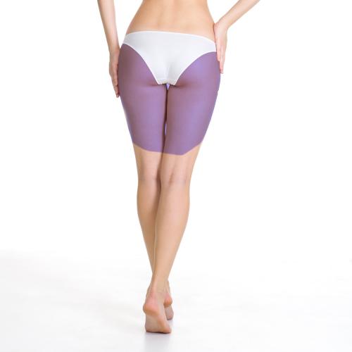 RF Vacuum · Back Thigh treatment area for women