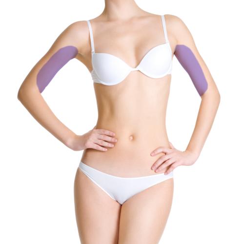 RF Vacuum · Inner Arms treatment area for women
